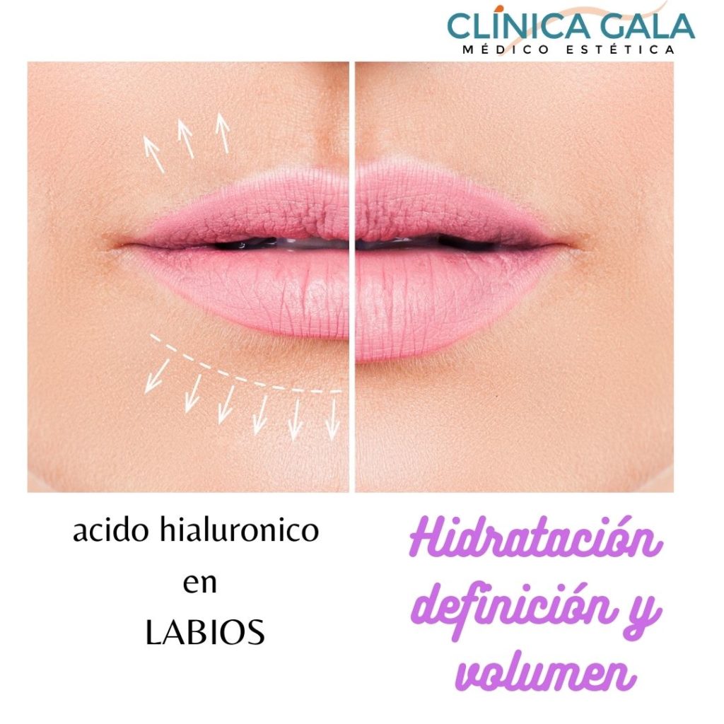 Hidratación De Labios Clínica Gala 8776